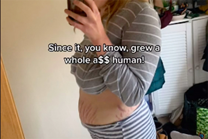 18-летняя блогерша показала тело после родов и испугала пользователей сети