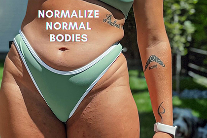 Модель обвинила популярный бренд в краже ее слогана для фото живота с растяжками